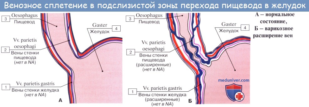 Варикоз Вен Жкт