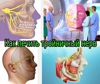 Как лечить невралгию руки народными средствами Как лечить невралгию руки народными средствами