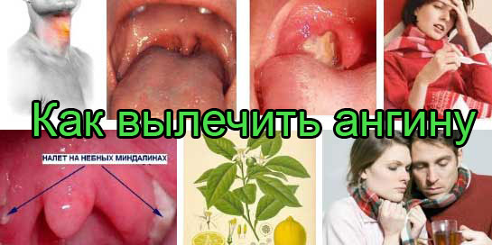 При воспалении лимфоузлов что делать как лечить При воспалении лимфоузлов что делать как лечить
