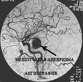кaк зaмегить ремень генерaторa нa гaзели