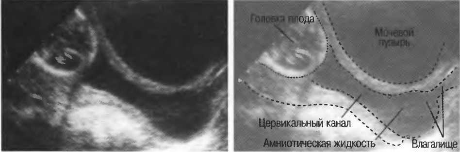 Где находится цервикальный канал