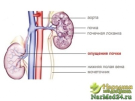Если болят почки лечение в домашних условиях Если болят почки лечение в домашних условиях