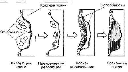 Метастазы схема. Схема цикличной перестройки кости. Ремоделирование кости. Перестройка компактной кости схема. Костная ткань схема перестройки.