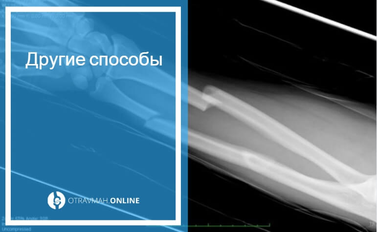 Как можно быстро сломать. Як бистро зломати руку. Як бистро зломати руку. Как можно быстро сломать. Как сломать рукац.
