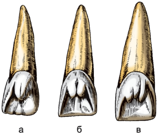 Центральных резцов. Центральный резец нижней челюсти анатомия. Центральный резец верхней челюсти анатомия. Медиальный резец верхней челюсти. Латеральный резец верхней челюсти анатомия.