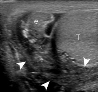 Узи яиц. Анатомия придатка яичка на УЗИ. Образование придатка яичка УЗИ. Привесок придатка яичка на УЗИ.