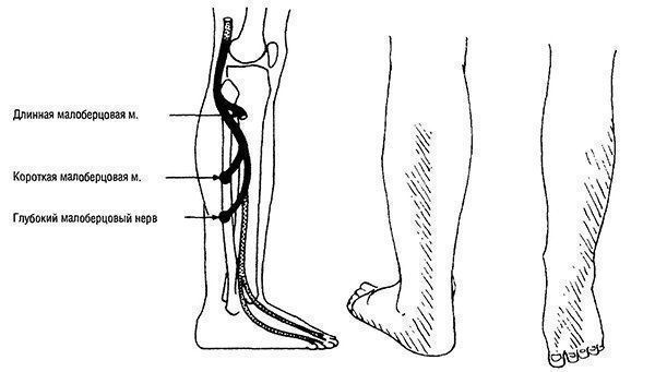Малоберцовый нерв анатомия схема