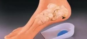 чем лечить шипы