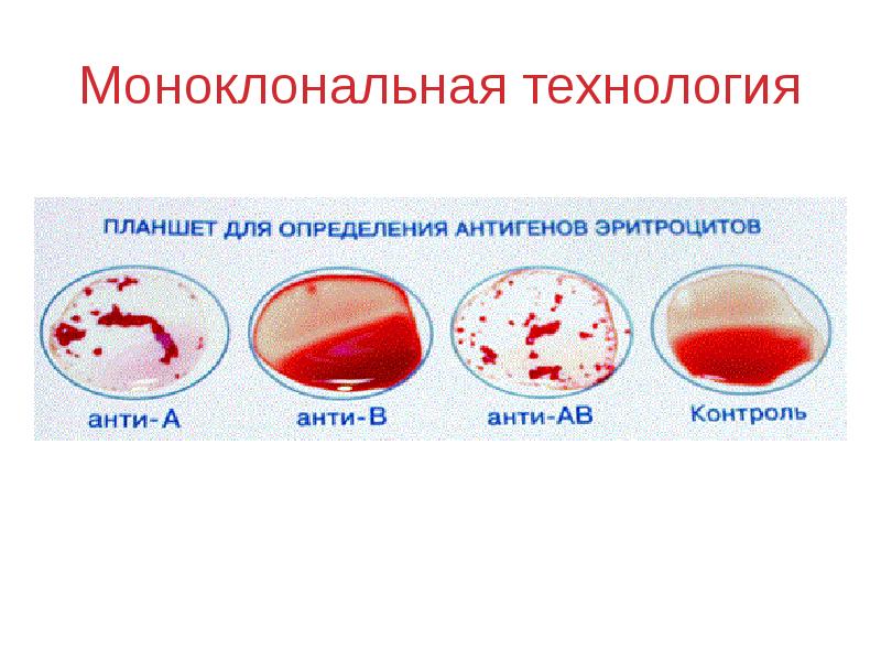Ответы нмо исследование антигенов эритроцитов в иммуногематологии. Основы иммуногематологии. Моноклональная технология. Иммуногематология картинки. Контроль ИММУКОР иммуногематология.