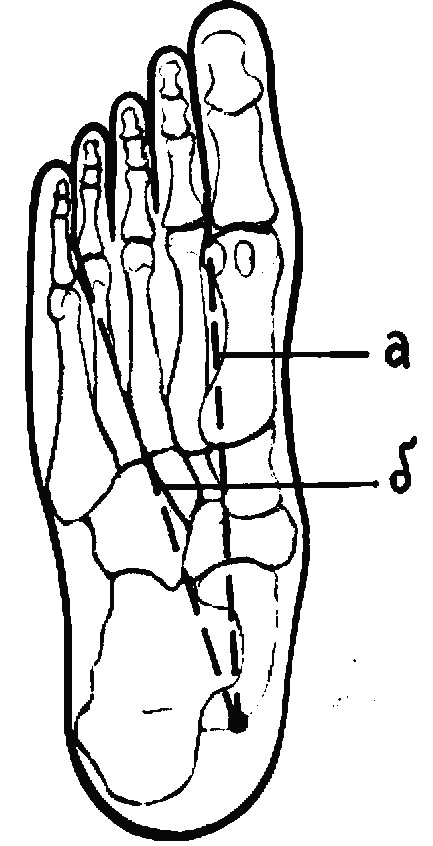 Линии подошвы. Проекционная линия тыльной артерии стопы. Проекционные линии магистральных сосудов конечностей. Проекция тыльной артерии стопы. Проекционную линию тыльной артерии стопы (a. dorsalis pedis):.