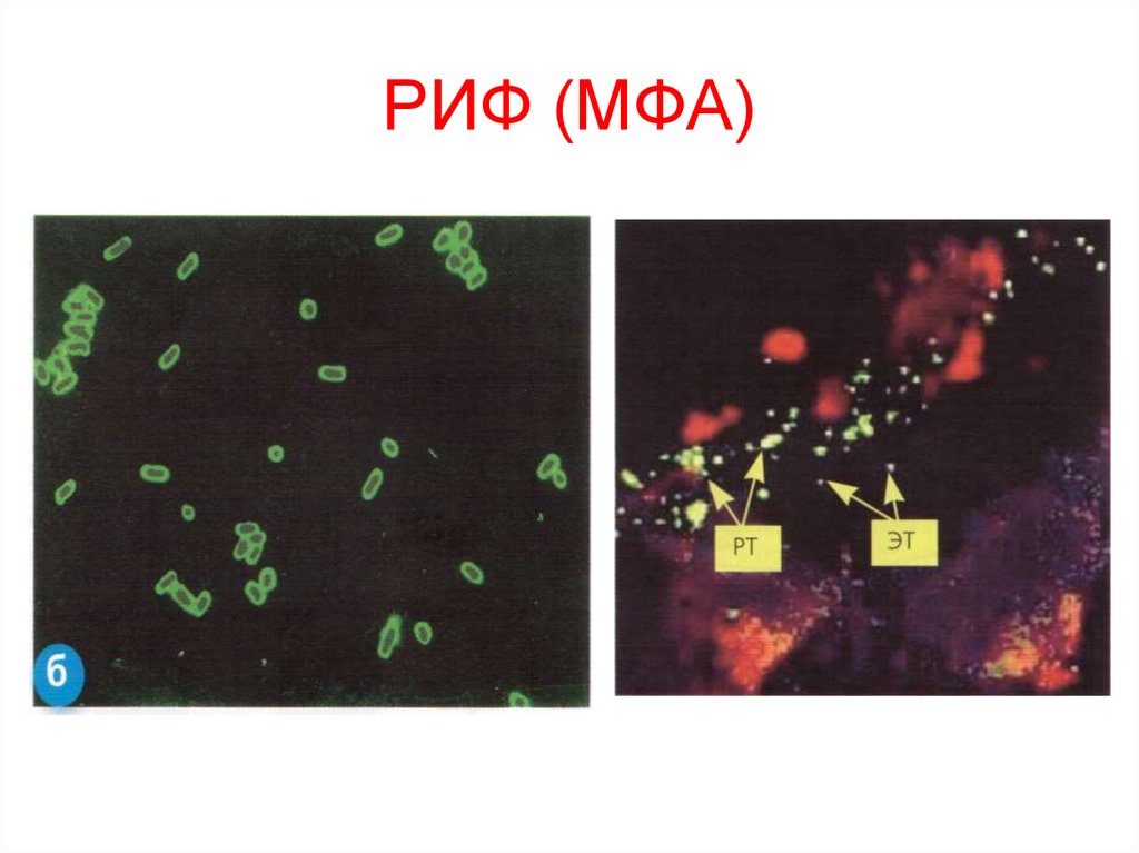Риф это микробиология. Прямой метод флуоресцирующих антител.. 2) МФА – метод флюоресцирующих антител. Метод флуоресцирующих антител прямой (МФА). Метод флюоресцирующих антител микробиология.