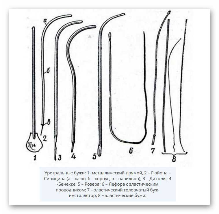 Мужская уретра. Бужи уретральные металлические прямые. Буж уретральный металлический прямой. Уретральные расширители трубки. Буж уретральный с эластичным проводником.