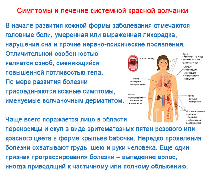 Волчанка Симптомы У Женщин Фото