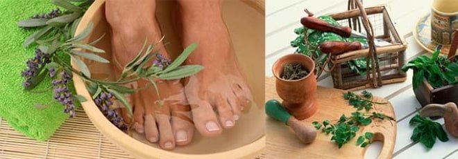 Как убрать отечность ног в домашних. Травяные ванночки для ног. Народное средство от отеков в ногах. Ванночка для ног с травами. Ванночки с травяными отварами.