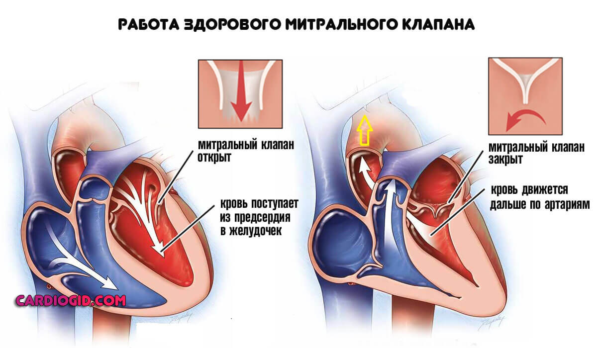 Пластика трикуспидального клапана