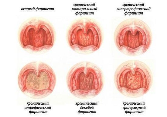 Здоровое горло ребенка 3 года