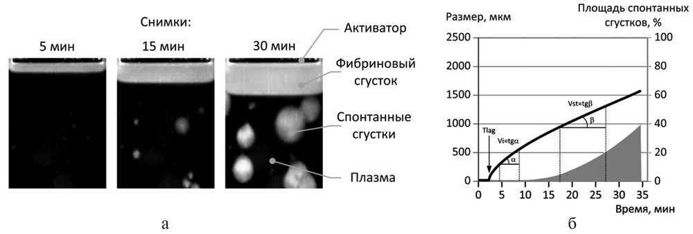 Тромбодинамика инвитро. Нормы исследования тромбодинамики. Исследование тромбодинамики при беременности. Тромбодинамика анализ. Тест тромбодинамики.