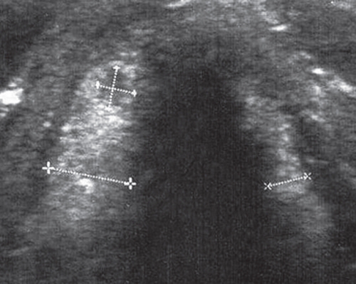 делают ли узи гортани