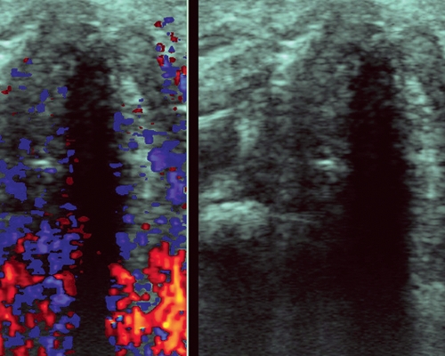 делают ли узи гортани