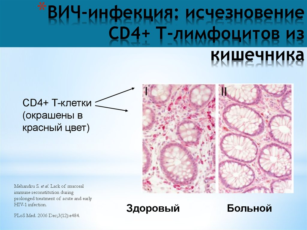 Какие клетки при вич