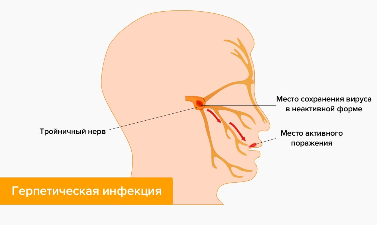 Тройничный нерв справа. Патология тройничного нерва симптомы. Воспаление тройничного лицевого. Невралгия тройничного нерва. Тройничный нерв на лице симптомы.