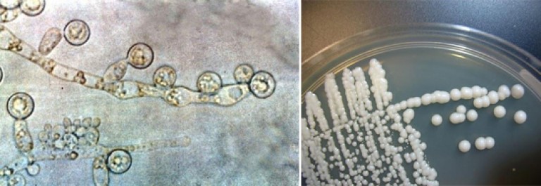 Молочница гриб. Кандида альбиканс под микроскопом. Хламидоспоры кандида. Кандида грибок микроскопия. Грибок кандида под микроскопом.