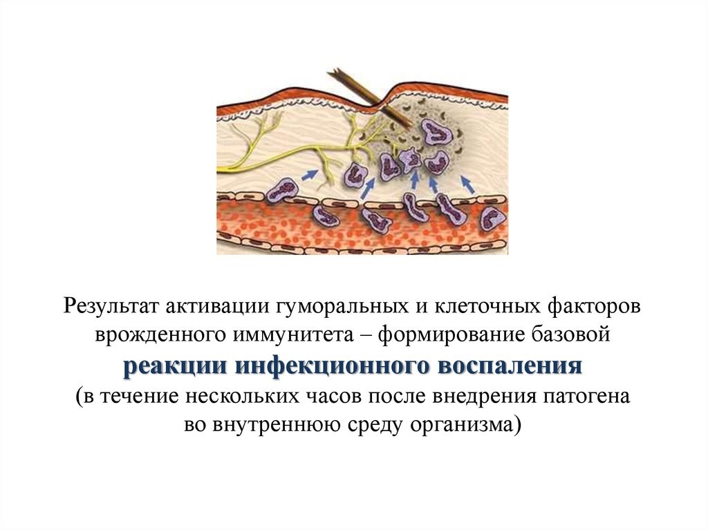 Воспалительная ткань. Врожденная защитная реакция организма. Клеточные факторы воспаления. Реакция базового инфекционного воспаления. Тимус это врожденный иммунитет.