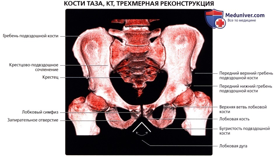 Кт подвздошной кости. Анатомия мужского таза на кт. Анатомия подвздошной кости кт.