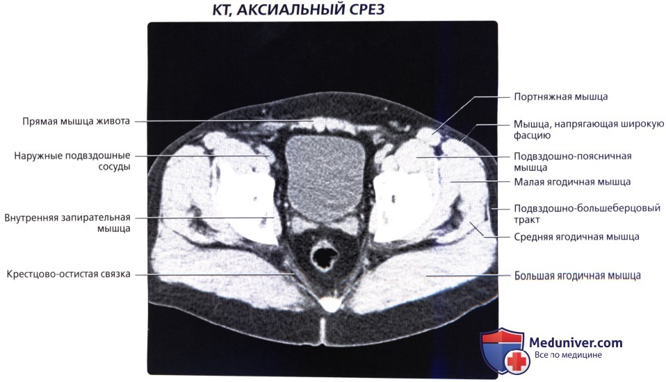 Кт Малого Таза Цена К31