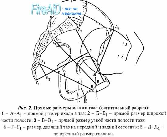 Прямой размер плоскости входа. Поперечный размер широкой части полости малого таза. Плоскости таза в акушерстве. Прямой размер плоскости входа в малый таз. Поперечный размер входа в малый таз.