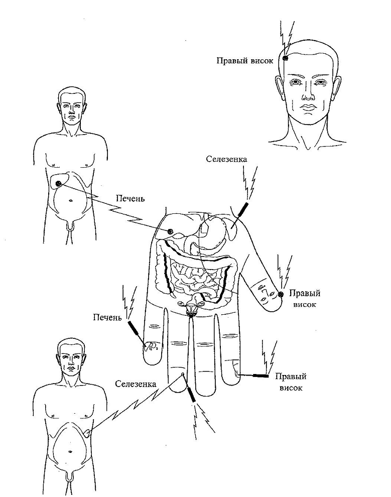 Точки соответствия. Семянотерапия пак Чжэ ву. Су Джок селезенка. Семянотерапия точки соответствия органам. Су Джок терапия геморрой.
