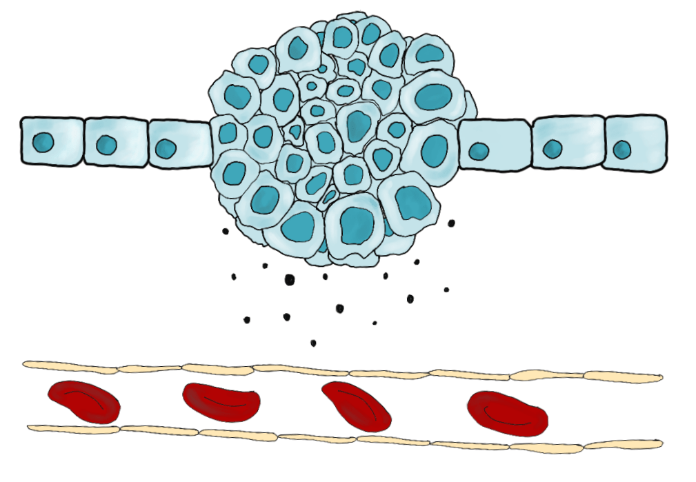 Вещество рисунок. Опухолевая клетка рисунок. Опухолевый ангиогенез рисунок. Выделение клетки. Эндотелий рисунок.