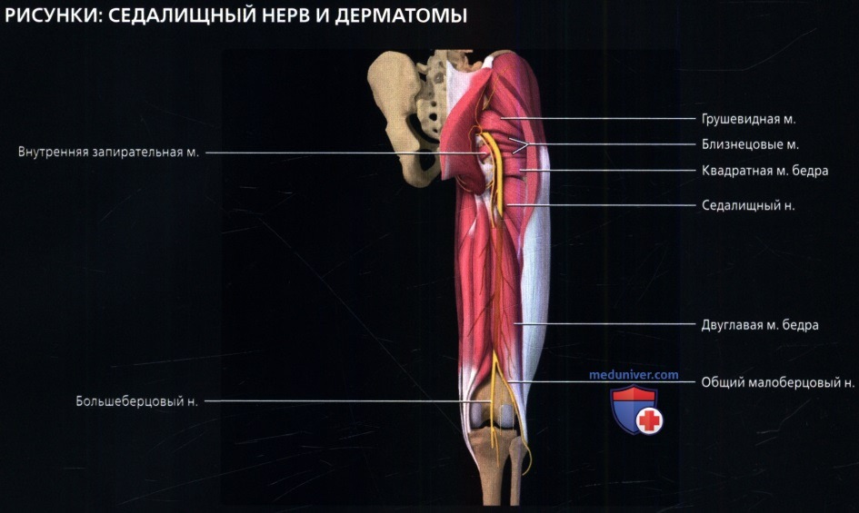 Нерв двуглавой мышцы. Бедренный и седалищный нерв анатомия. Мышцы седалищного нерва. Сухожилие двуглавой мышцы бедра. Седалищный нерв и мышцы бедра.