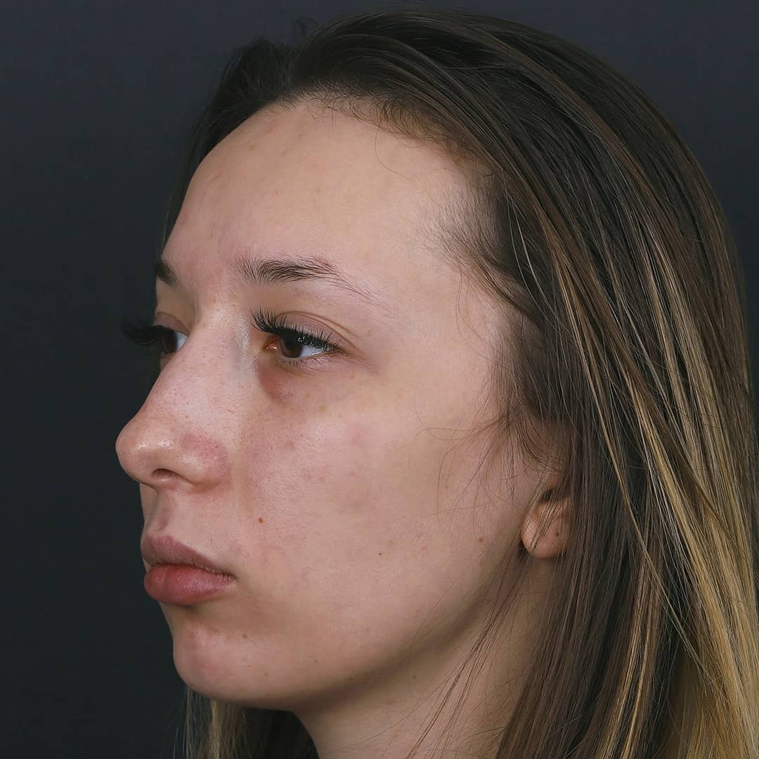 Женщины с горбинкой на носу