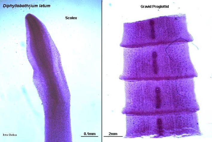 Diphyllobothrium latum