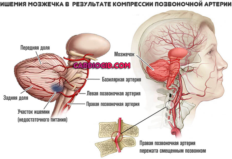 2227259-ishemiya-mozzhechka-v-rezultate-