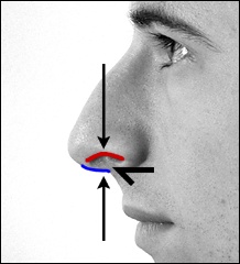 Точечный самомассаж при гайморите. Как открыть ноздрю. Ринопластика хряща на кончике носа. Как открыть ноздрю. Насморк.
