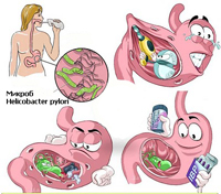 Профилактика гастрита картинки