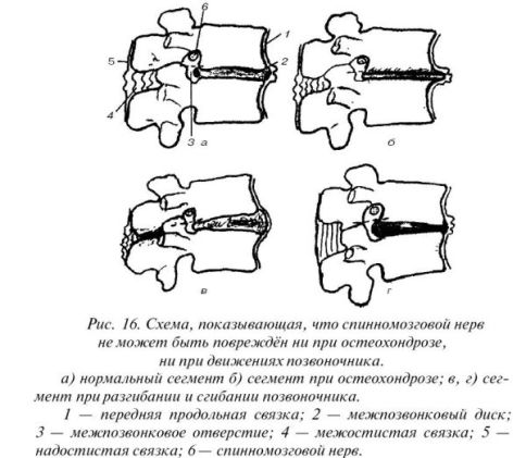схема прохождения спинномозгового нерва при остеохондрозе
