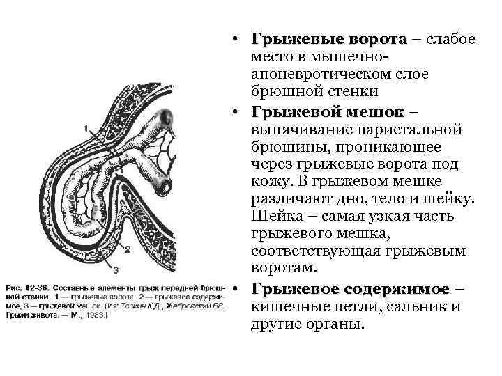 Внутренние органы могут составлять часть стенки грыжевого мешка при следующих грыжах тест