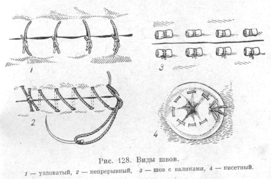 Хирургические швы. Хирургические швы в ветеринарии. Непрерывный Узловой шов хирургический. Наложение хирургических швов Ветеринария. Кисетный хирургический шов.