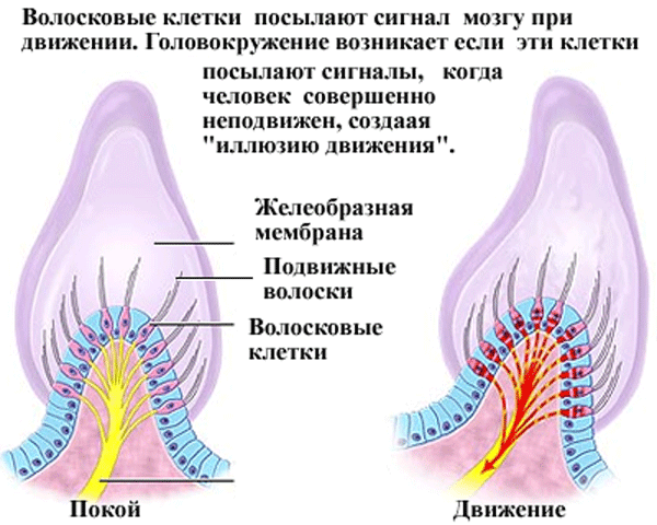 Головокружение при вставании с кровати причины