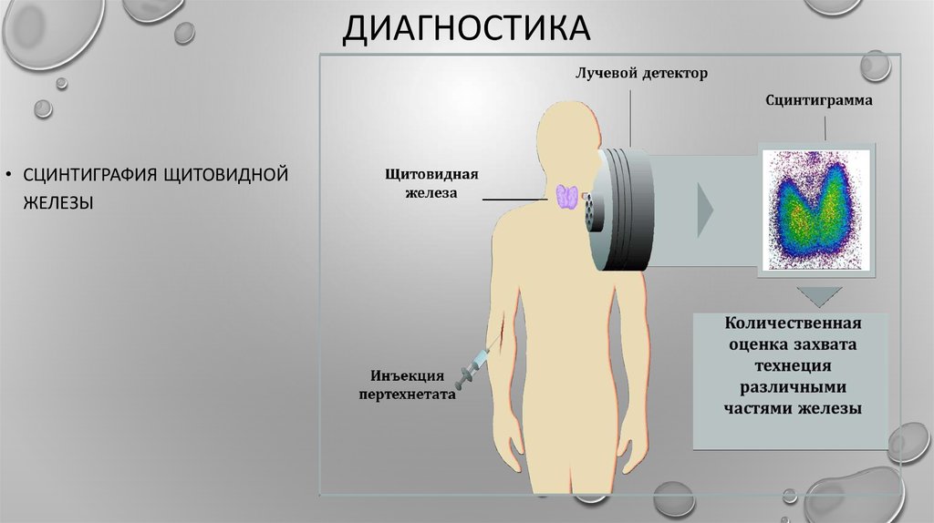 Сцинтиграфия щитовидной железы это