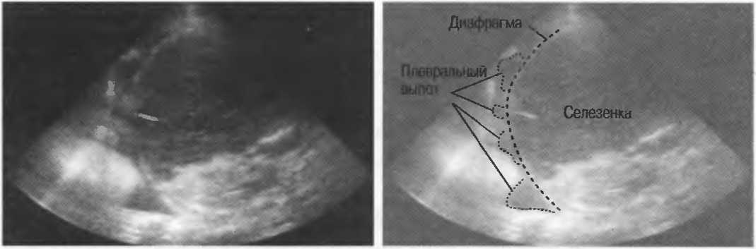 Долька селезенки