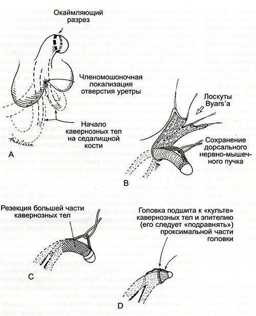 Очко Альбины расширяется от каждого проникновения